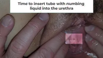 Ex-Wife gets finger nailed and urethral play from husband pov