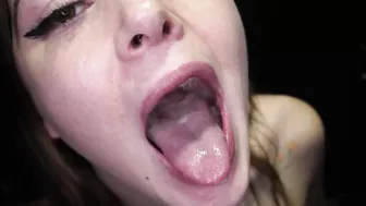Damn Alex right in your eye