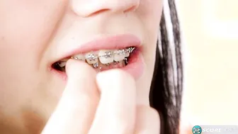 Sex-obsessed slim teen with puffy nips and braces spreads wide