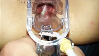 Skank wifey outdoor speculum play