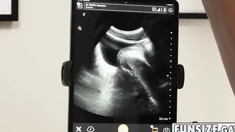 ANAL ULTRASOUND I could die to see this Doctor