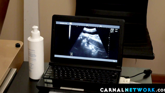 Austin Young and the doctor watched from the x-ray screen a bare cock throbbing in hi