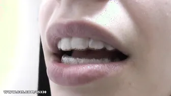 Release For My Plastic Retainer