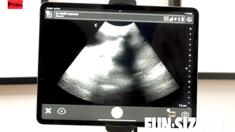 FunSizeBoys Grant Ducati and Dr Legrand Wolf ultrasound sex scene