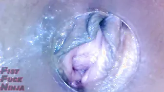 Twat Endoscope of Japanese cougar AGAIN