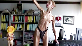 Skin and bones