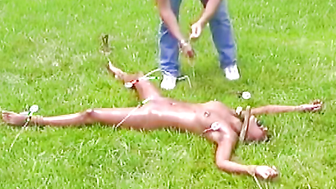 Sunburn bondage
