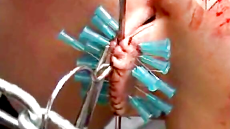 Her pussy is sewed with a cathader then clit pinning
