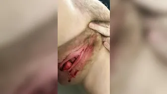 TIME OF THE MONTH - DRIP DRIP DRIP
