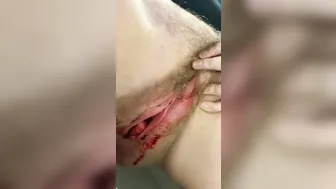 TIME OF THE MONTH - DRIP DRIP DRIP