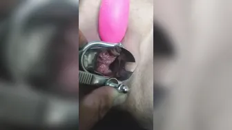Close up Speculum and Internal Veiw of Squirting