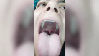 Tongue and Throat as I Laugh and make Noises to make Uvula Twitch