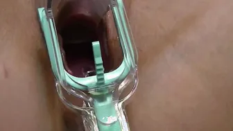 Self Examination with Speculum and Cervix Play