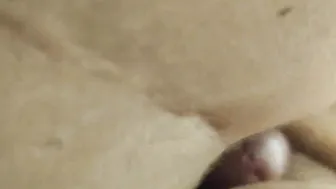 Foreskin