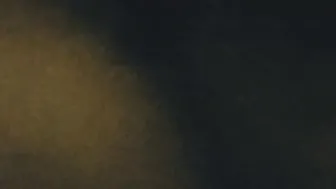 Small Disabled Whore Takes Anal Pounding from Nurse Painful