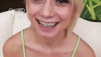 This four toes 11 brace faced 18 yo give a BLOWJOB
