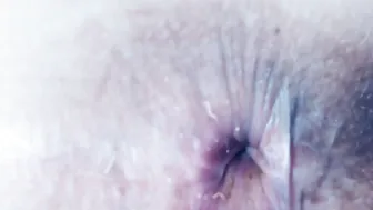 Bimbo Whore Milf Spreads Nasty  Ripe Asshole - Slut
