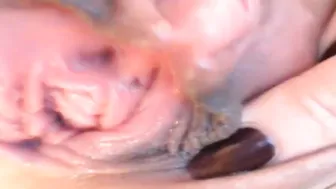 Thai Huge clitoris and clitoris pump