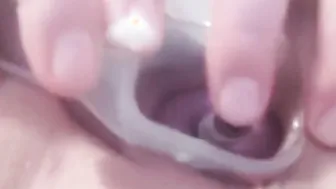 Cervix performance plowed and pump