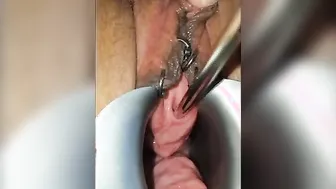 Sounding porn video – Peehole Sounding and Finger into his Urethra