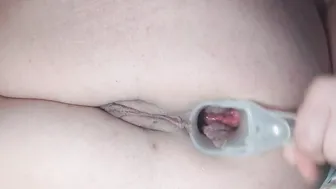 Anal Speculum Play