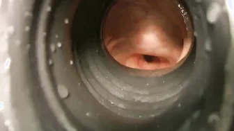 Hotkinkyjo 99cm Deep Sex Toy Anal Penetration Prolapse  more