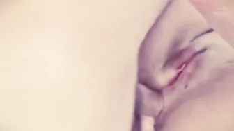 Simple Anal