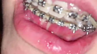 SLUTS WITH BRACES SHOWS HER MOUTH INTO ASMR