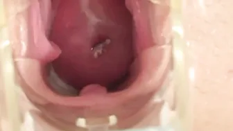 Speculum Bae spreading lips and masturbating vagina