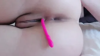 Silicon Melons and Bald Vagina Play