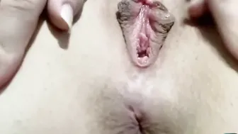 Culazo De Perra