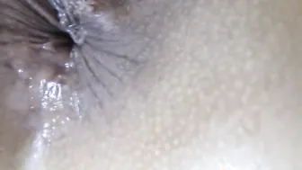 bitch opens anal hole