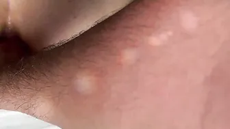 Working out the anal hole of a cougar I want her anal to become gigantic and broken. Amateur ANAL FISTING.