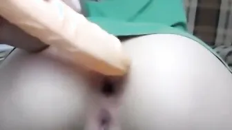 Do You Want to Fill My Holes?