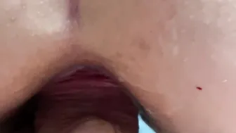 sexy Stepmom Anal. Anal Chubby. Chubby Amateur Anal. STANDING ANAL. Gaping asshole. Gigantic butt anal.