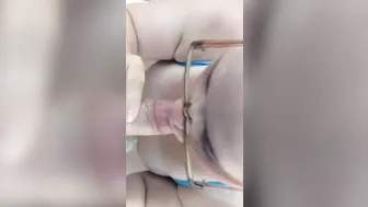 Outside oral sex