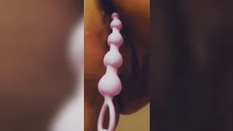 Asshole