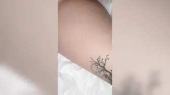 Wartenberg wheel