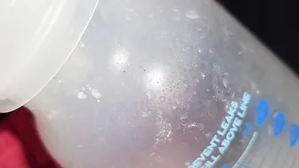 Imagine this was your mouth