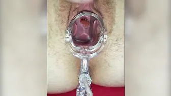 Vagina getting fisted and opened with a speculum