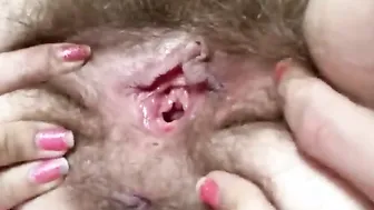 Huge clitoris rubbing closeup masturbation unshaved vagina leaking w