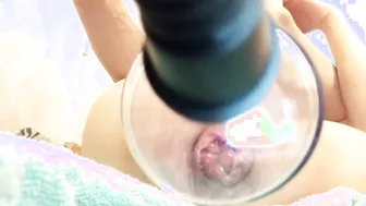 Pumping porn video – INTENSE ANAL FIST FUCKING PROLAPSE WITH PUMP | ALBEDO666