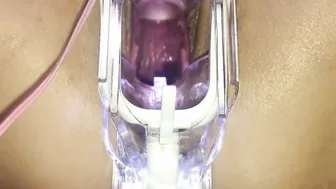 Japanese Cunt With SpeculumMasturbating.