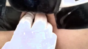 Anal dilation and inspection with orgasms