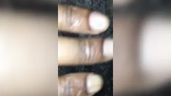 Kinky vagina with hair