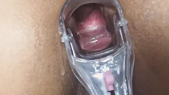Speculum inside my anus