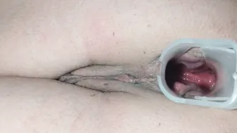 Аnal speculum point of view