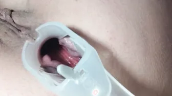 Аnal speculum point of view