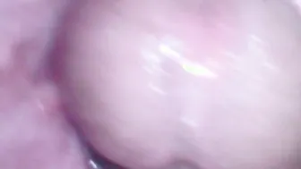 Endoscopy plowed the twat