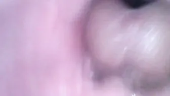 Endoscopy plowed the twat